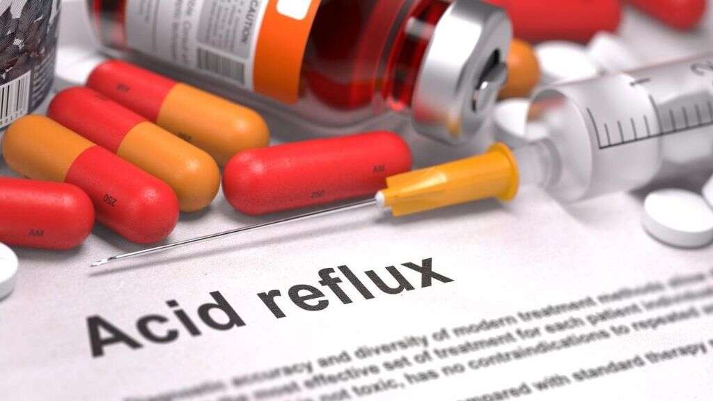 Acid Reflux