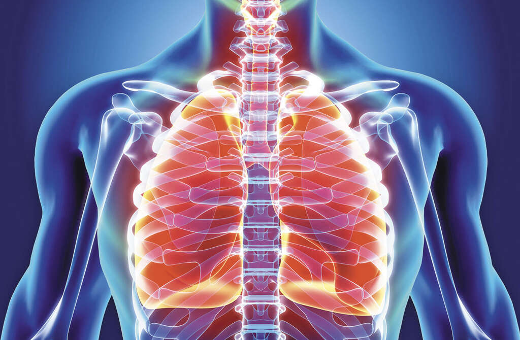 Acute Bronchitis