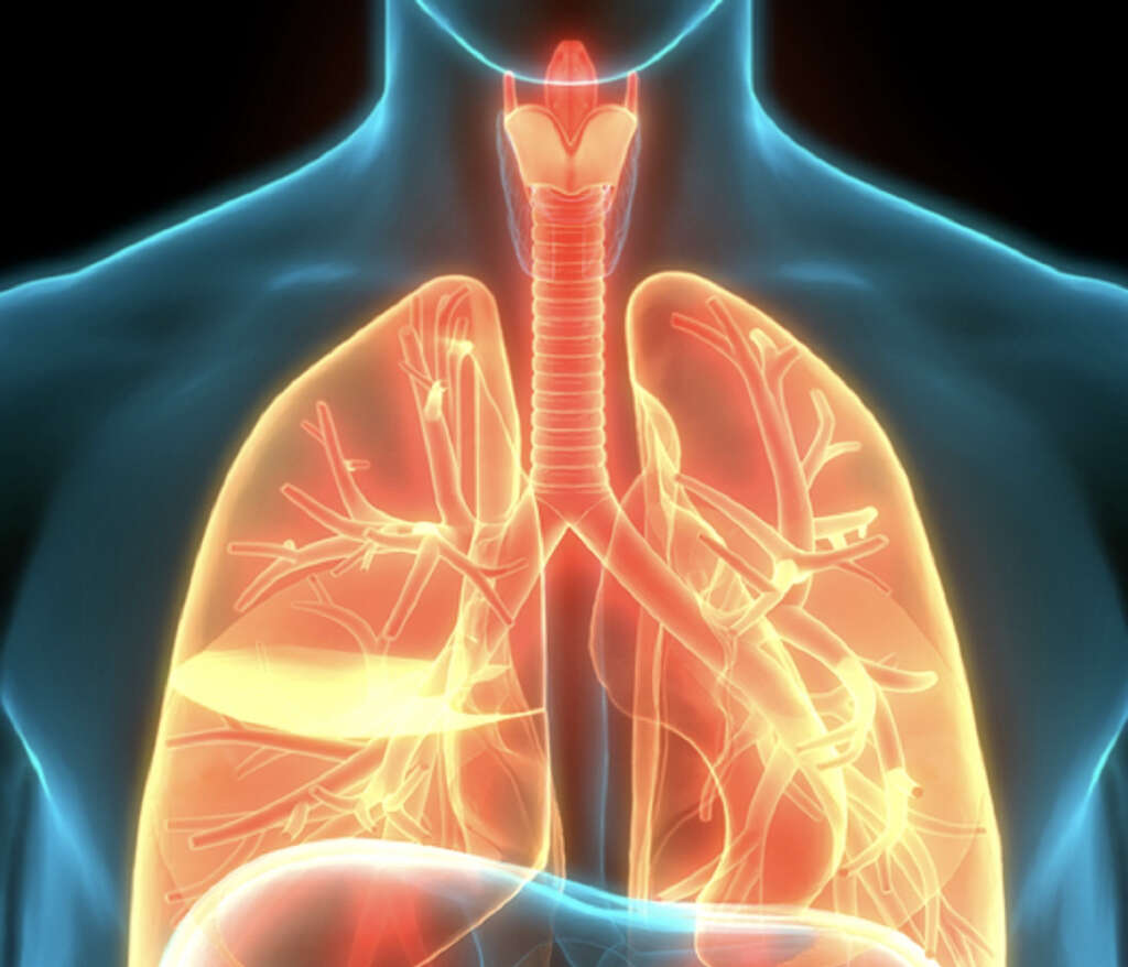 Acute Bronchitis