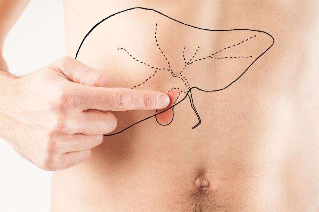 Acute Cholecystitis