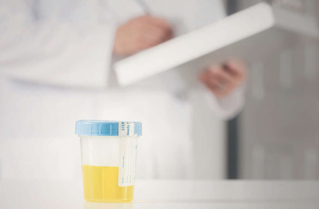 Acute Renal Failure