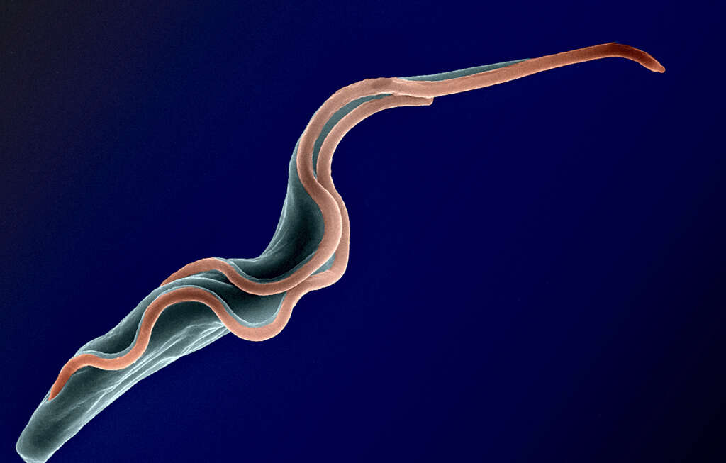 African Sleeping Sickness