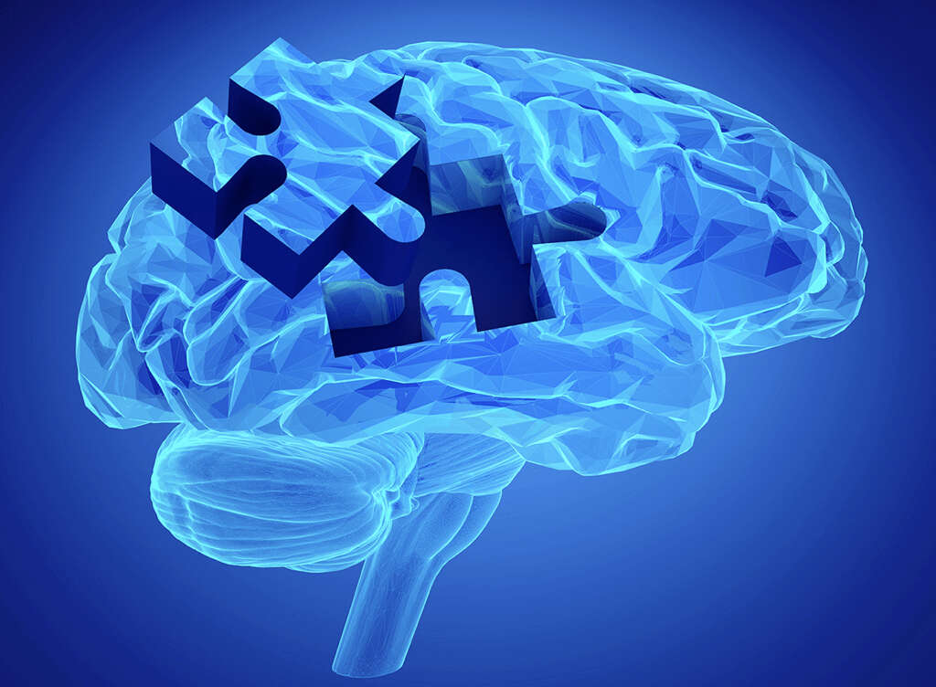 Alzheimer's Disease
