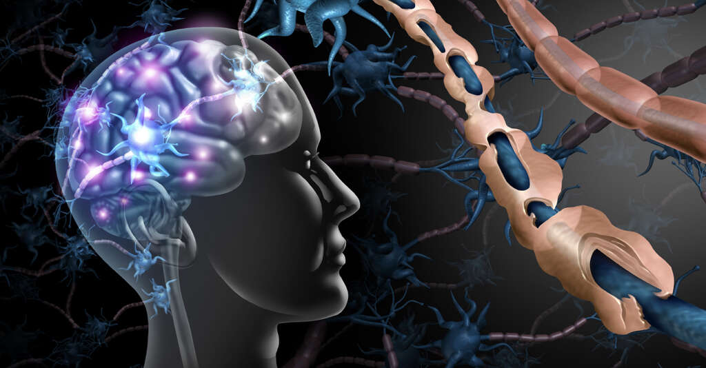 Autoimmune Disease