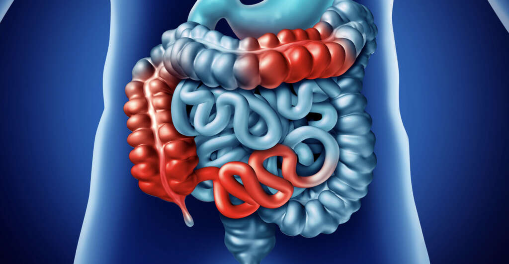 Autoimmune Disease