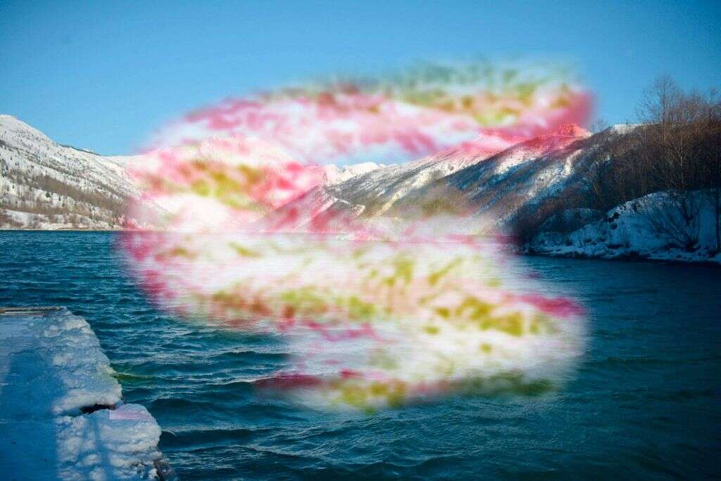 Ocular Migraine