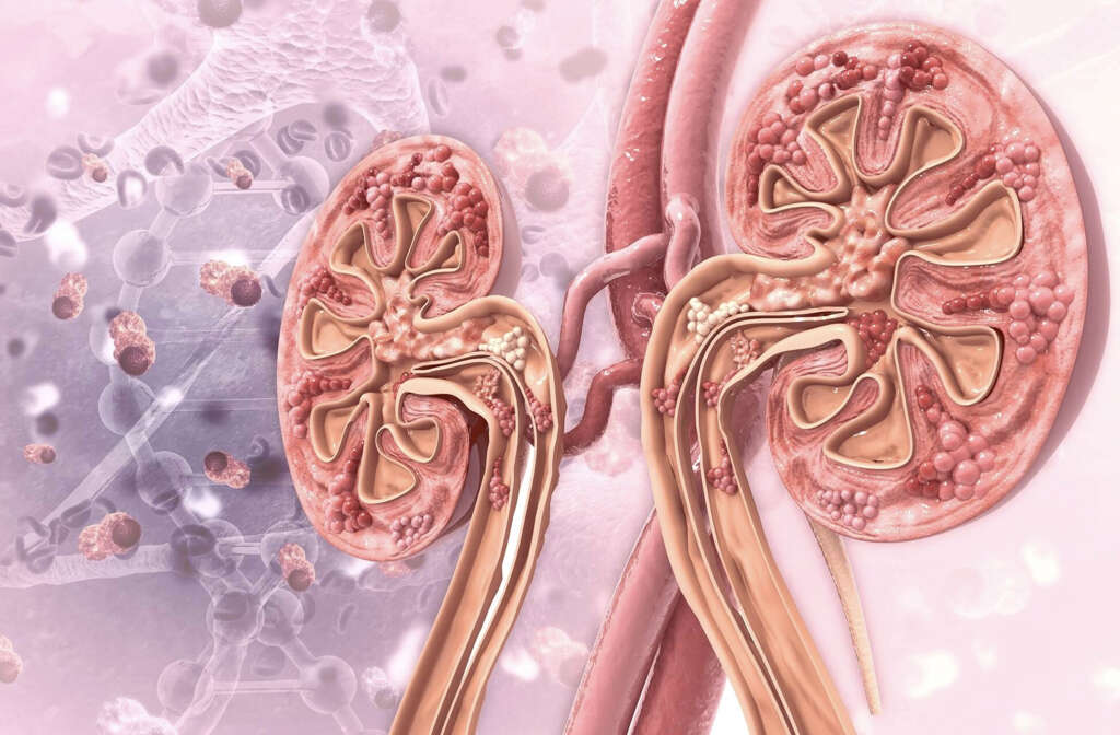 Anaplasmosis