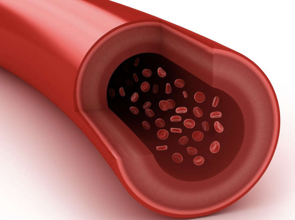 Antiphospholipid Syndrome