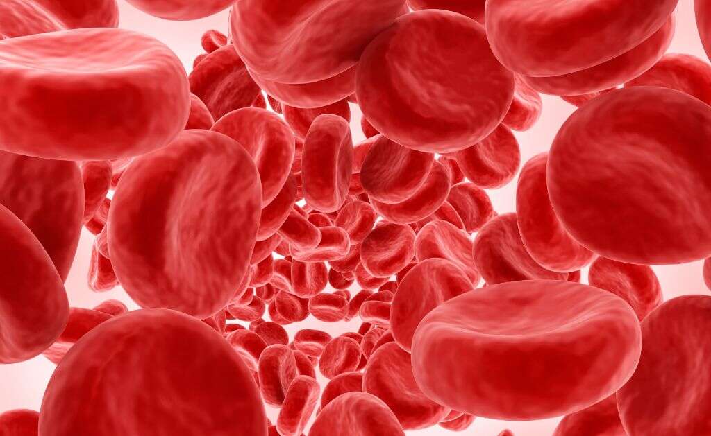 Aplastic Anemia