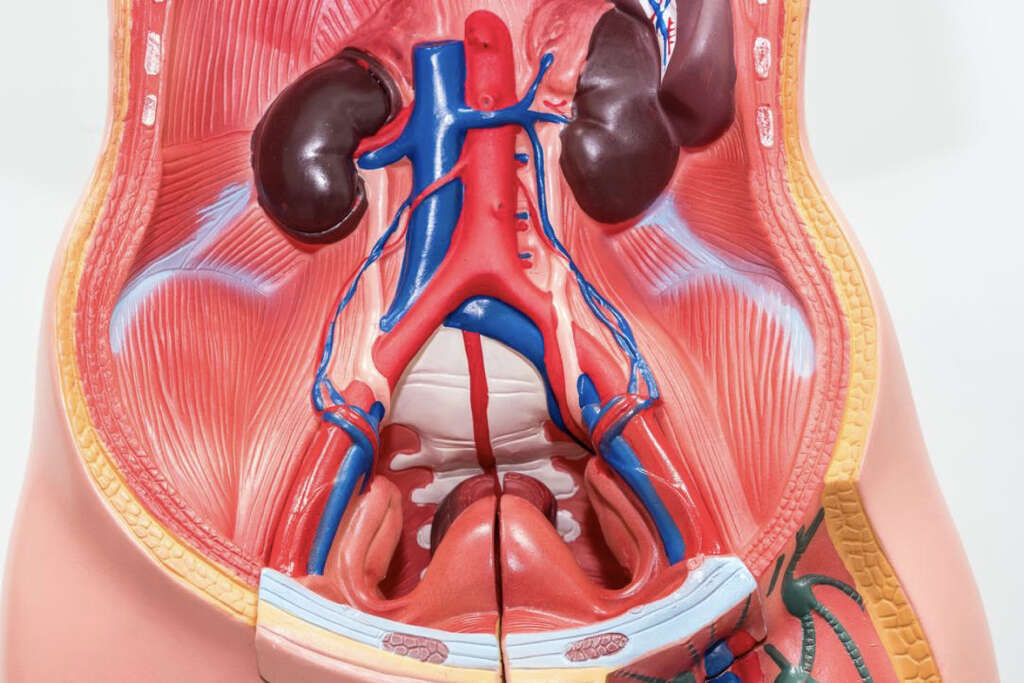 Ascites