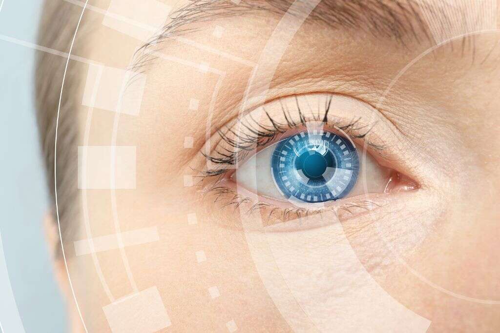 Astigmatism