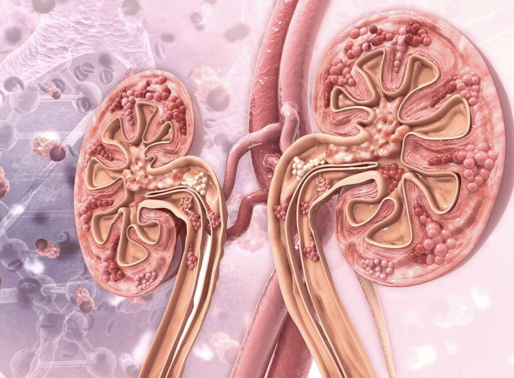 Atherosclerotic Cardiovascular Disease
