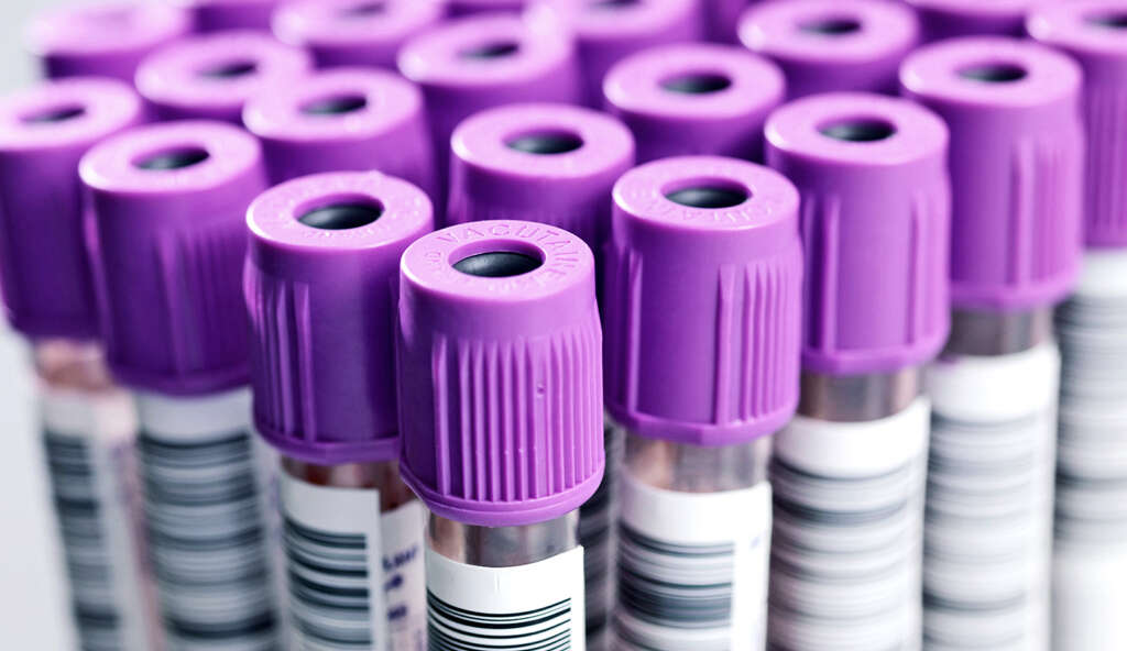 Atherosclerotic Cardiovascular Disease