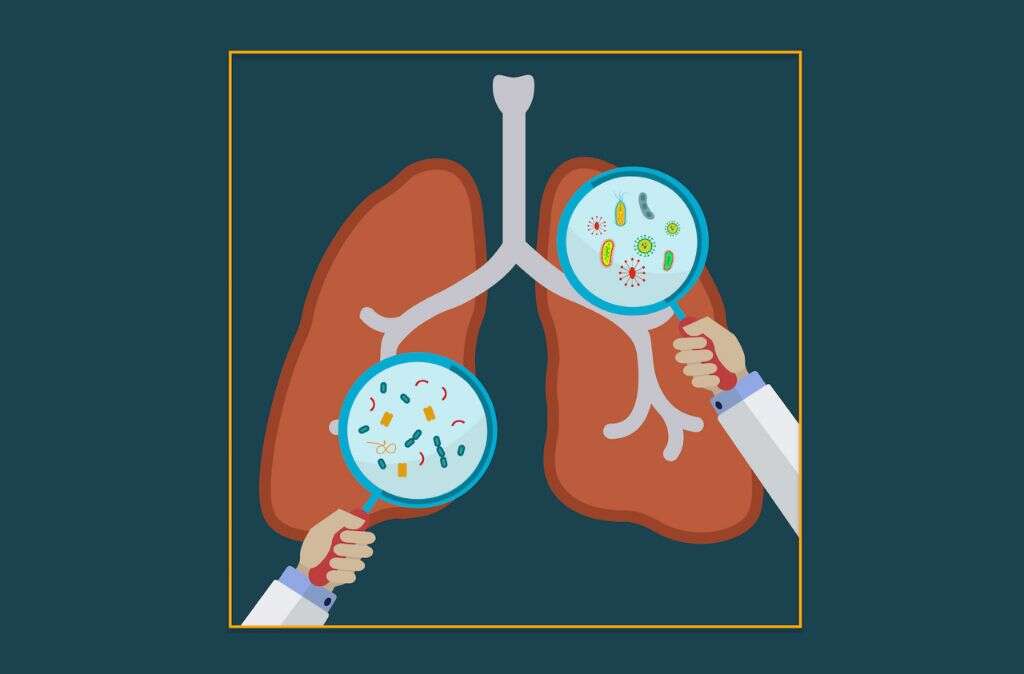 Atypical Pneumonia