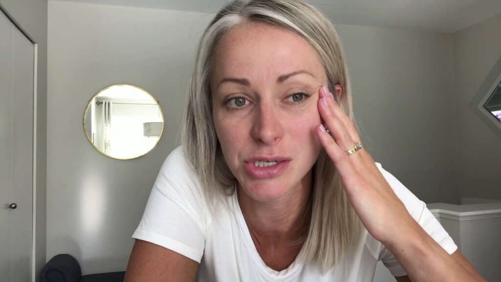 Bell's Palsy