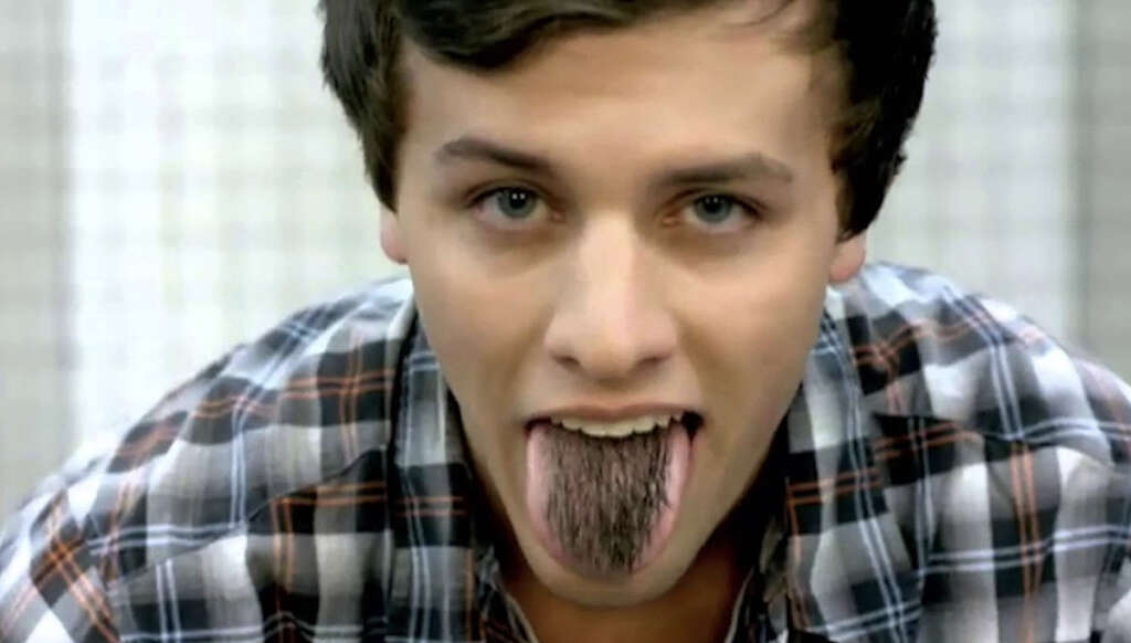 Black Hairy Tongue