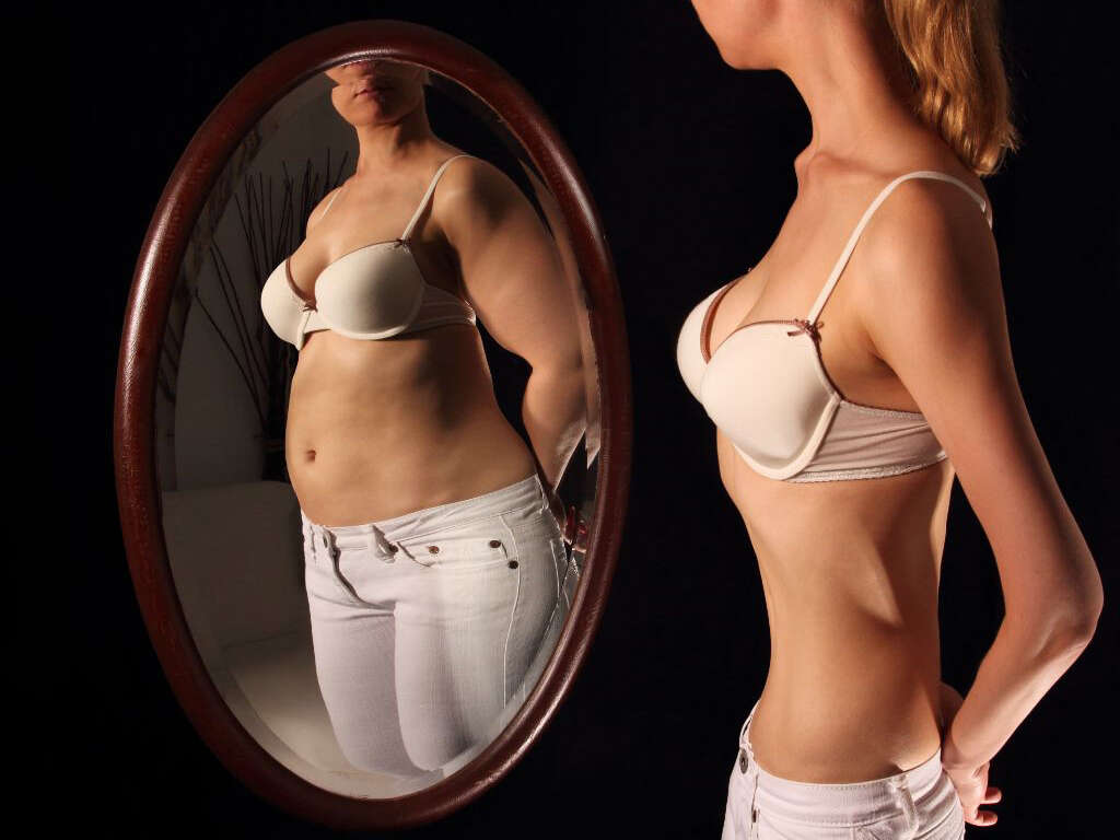 Body Dysmorphic Disorder