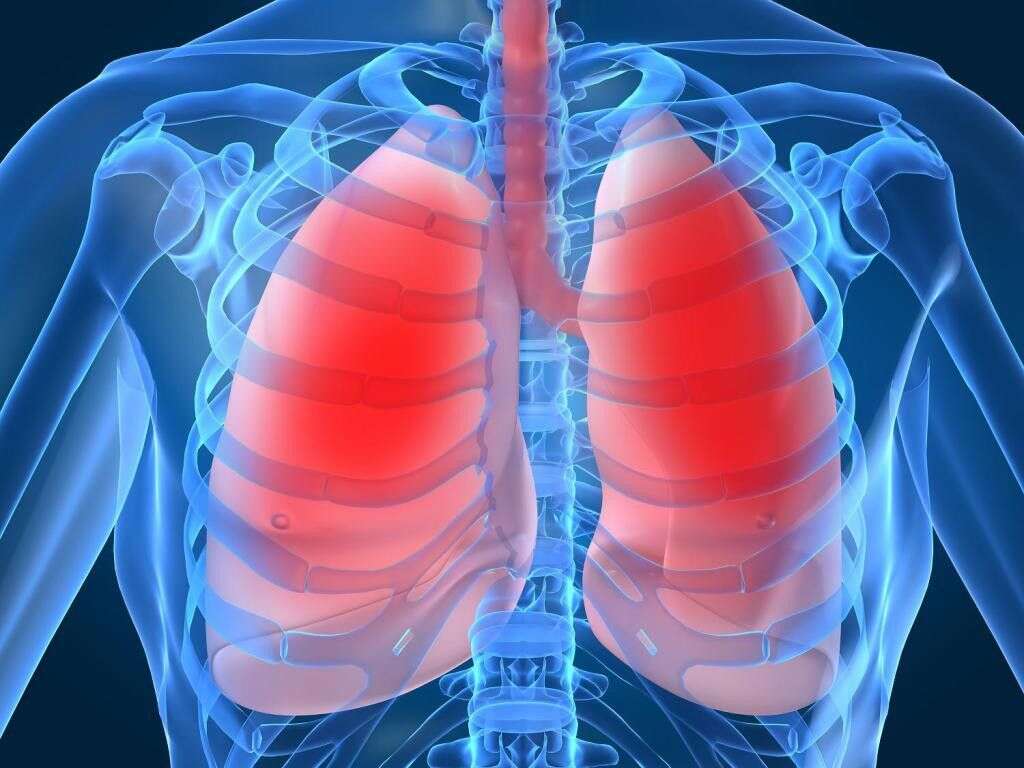 Bronchiolitis