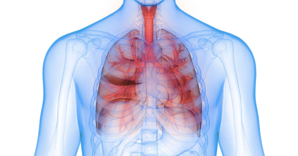 Bronchitis