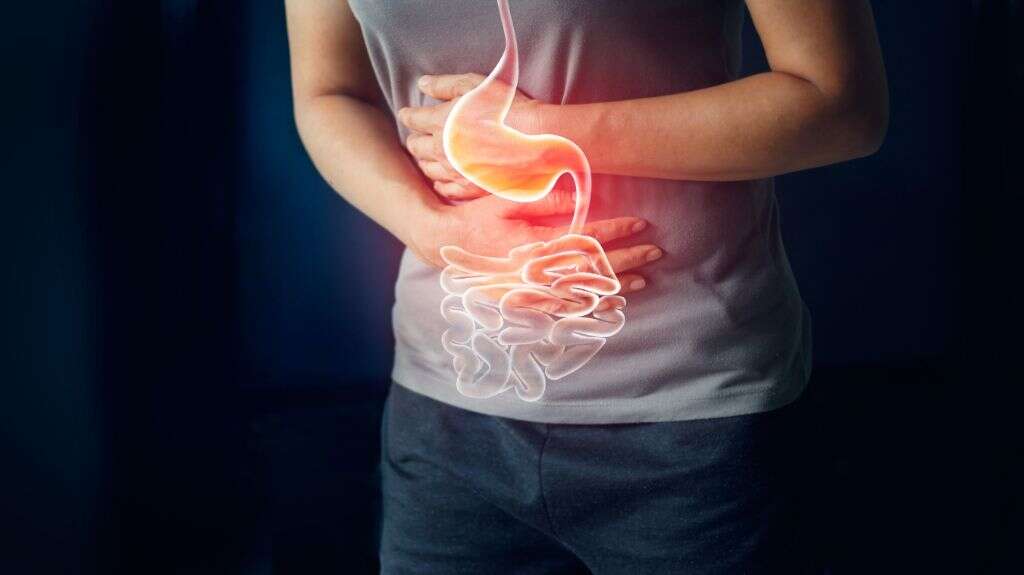Budd Chiari Syndrome