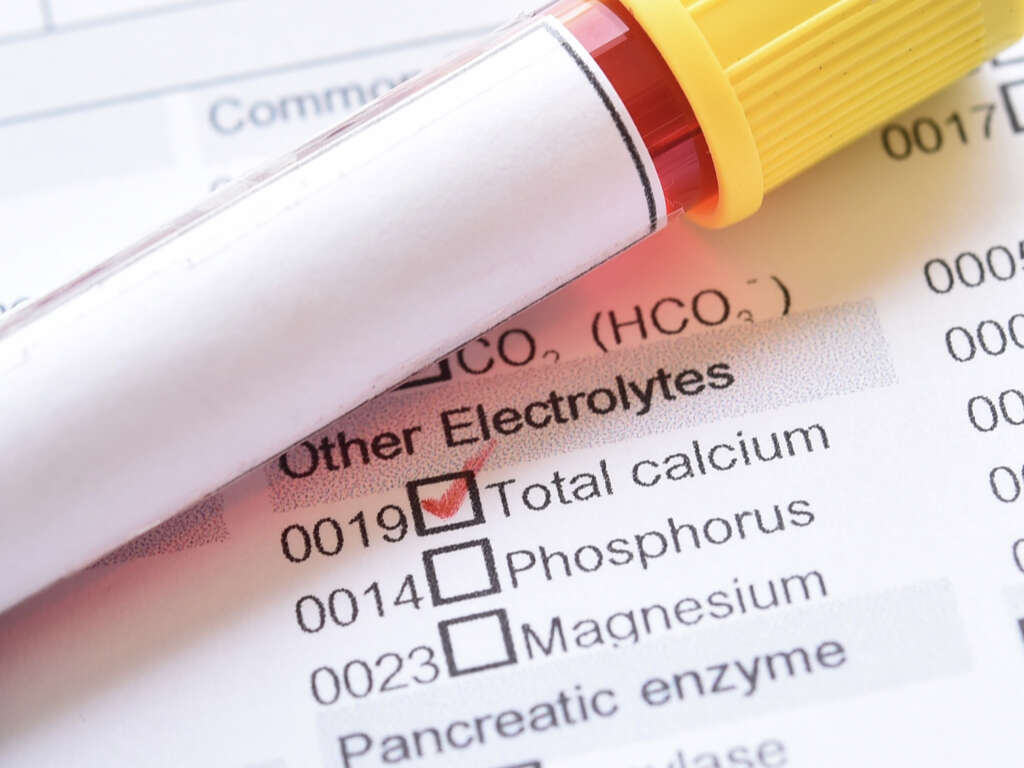 Calciphylaxis