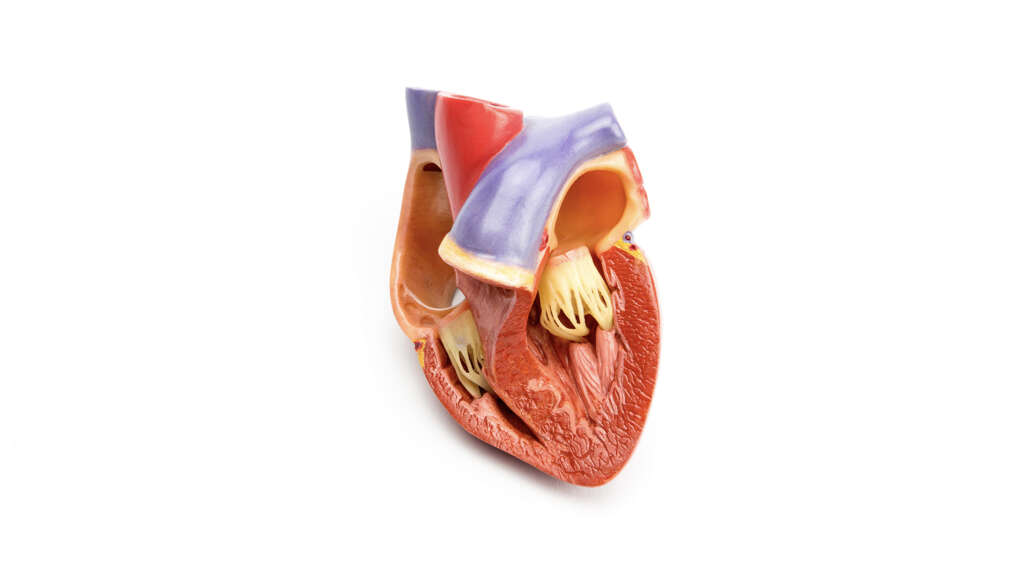 Cardiomyopathy