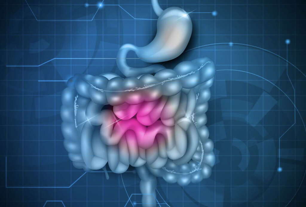 Cholangitis