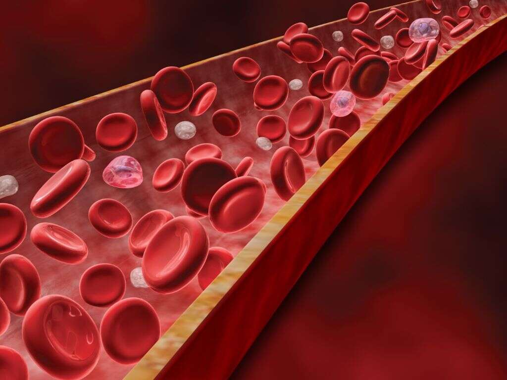 Cholecystitis