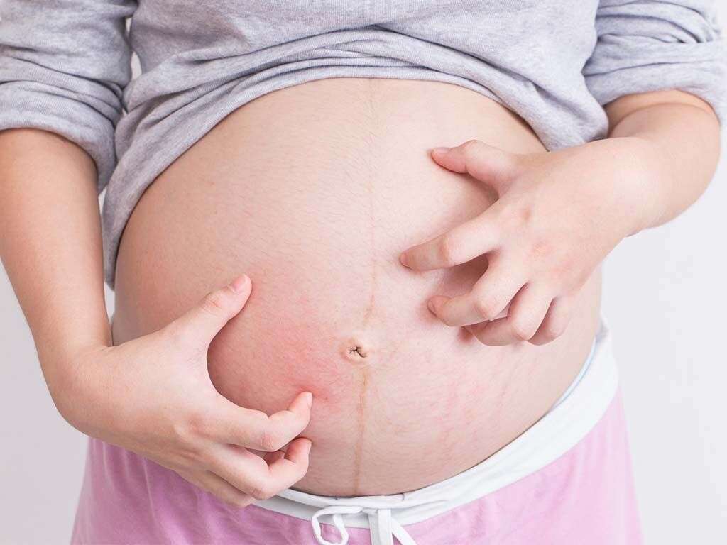 Cholestasis