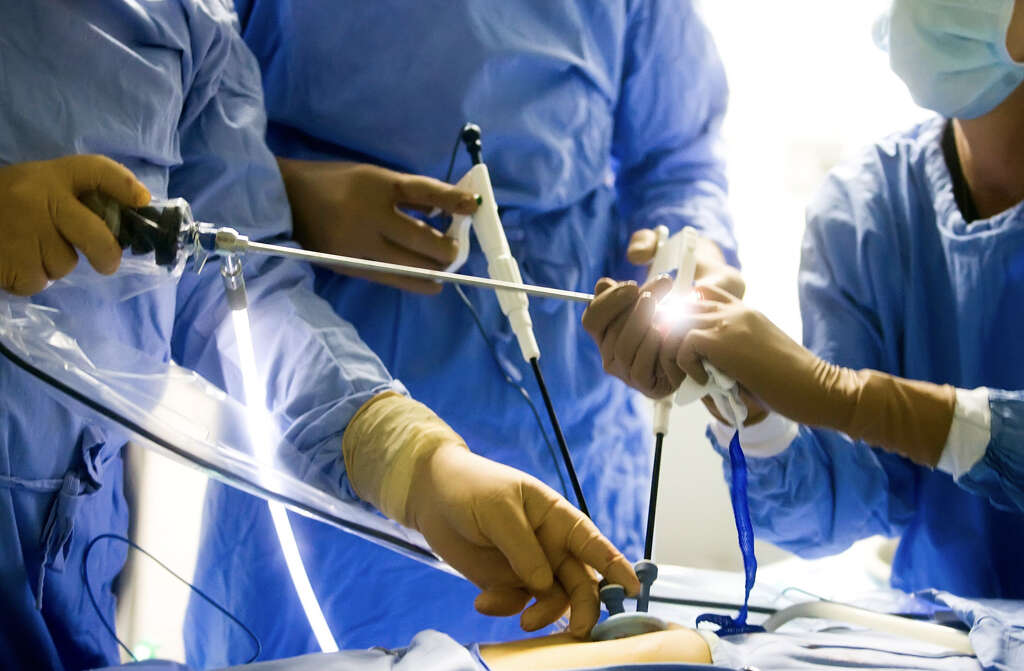 Chronic Appendicitis