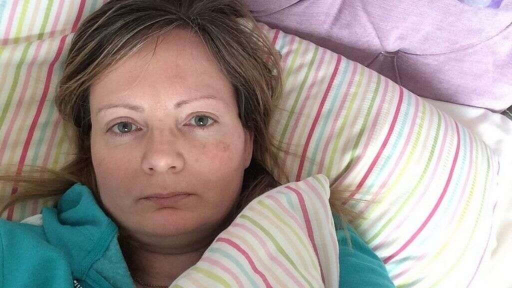 Chronic Fatigue Syndrome