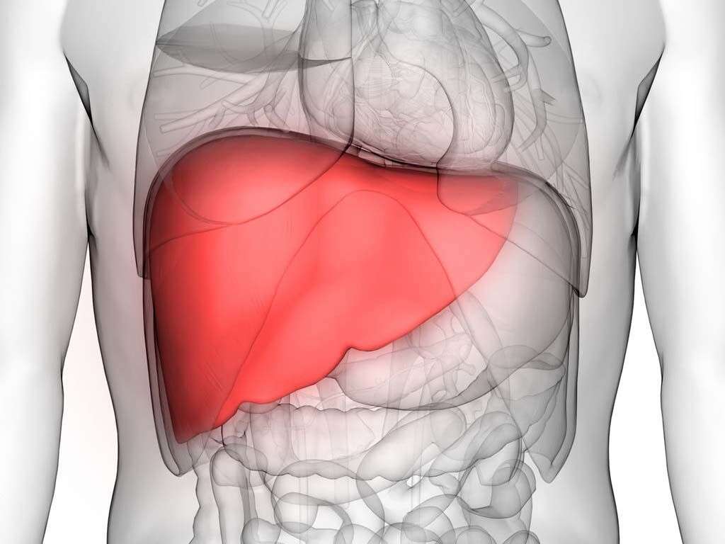 Cirrhosis