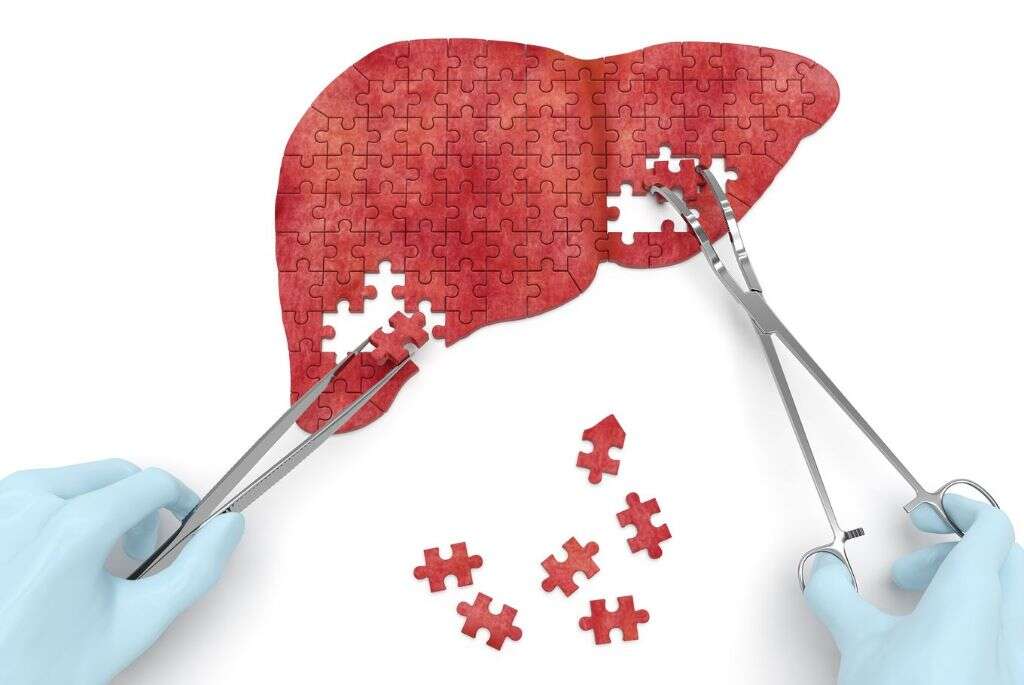 Cirrhosis Of The Liver