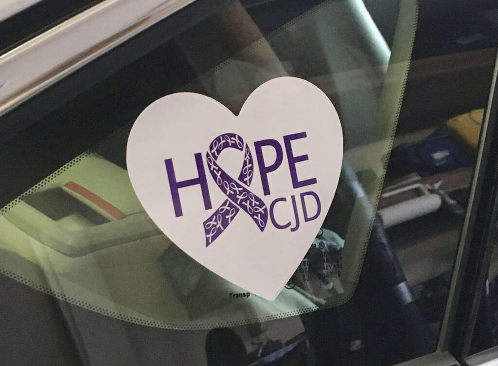 CJD