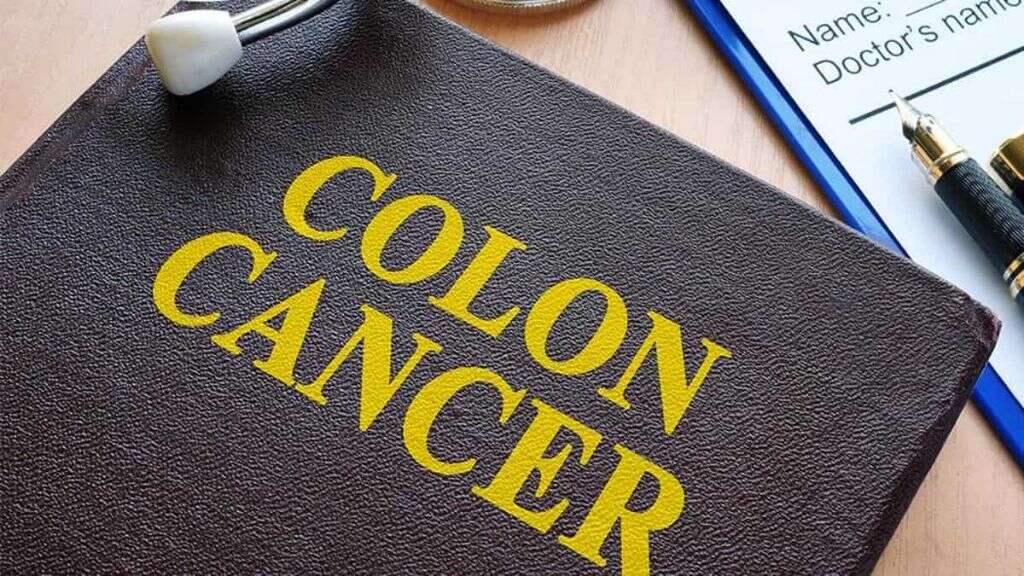 Colon Cancer