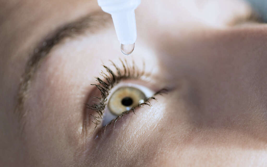 Conjunctivitis