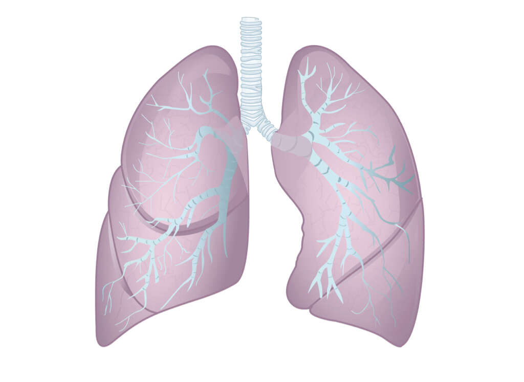 Cor Pulmonale