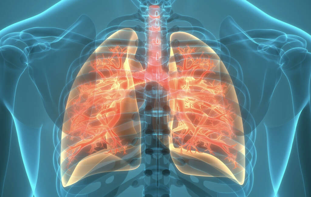Cor Pulmonale