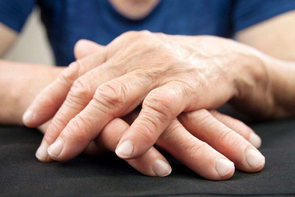 Cubital Tunnel Syndrome