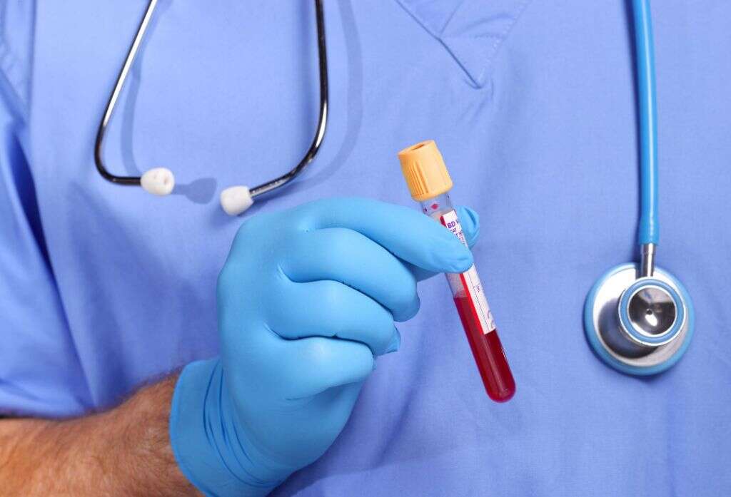 Deep Vein Thrombosis
