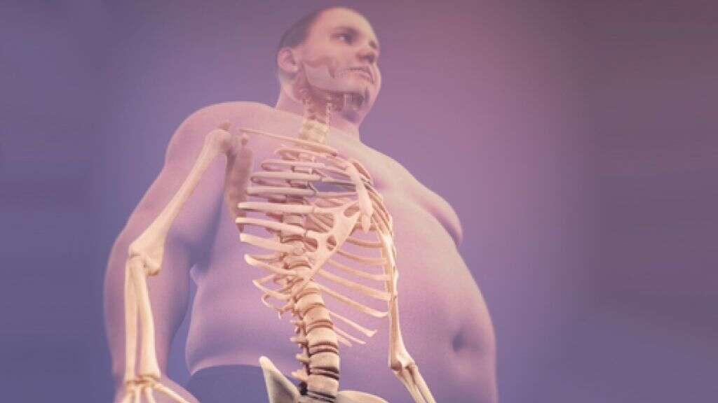 Degenerative Joint Disease