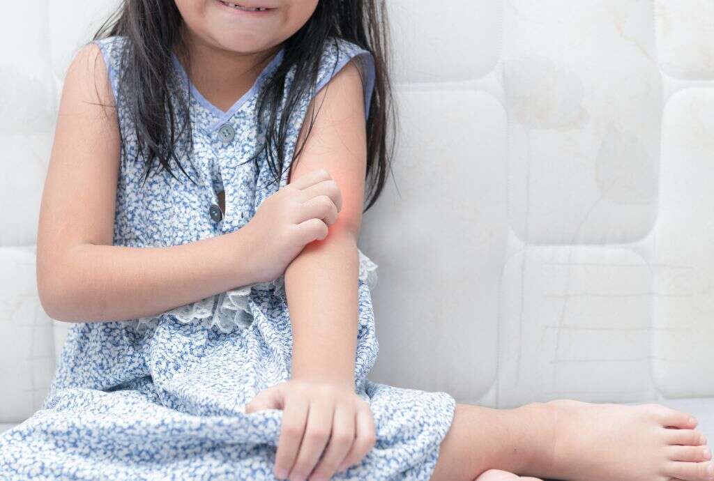 Dermatomyositis