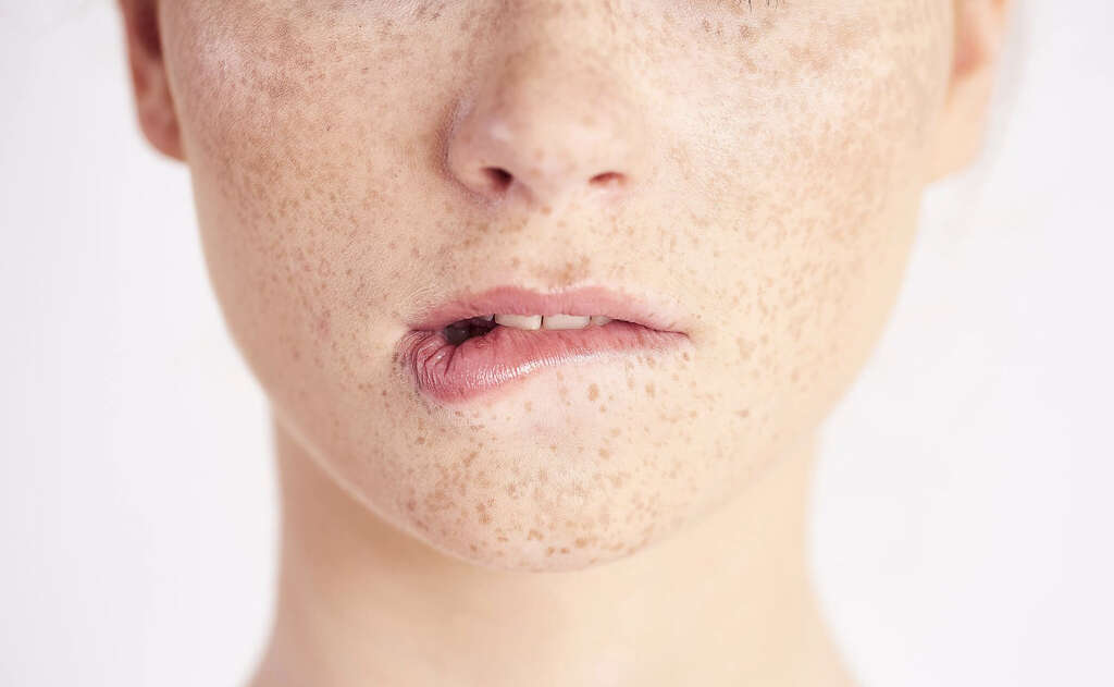 Dermatophagia