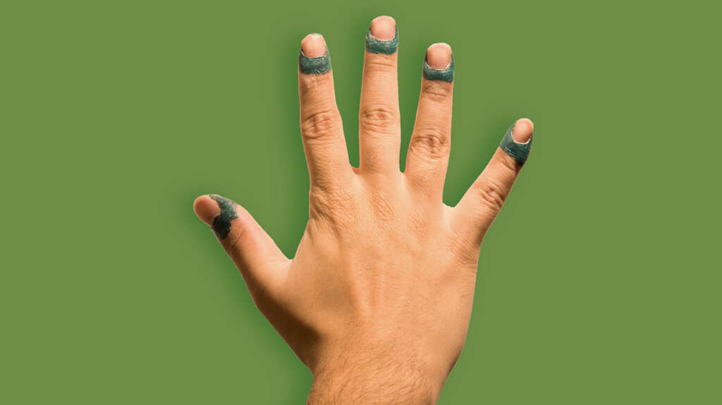 Dermatophagia