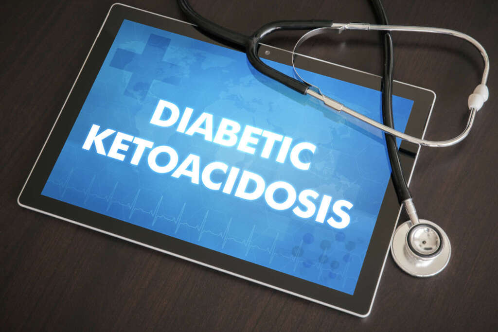 Diabetic Ketoacidosis