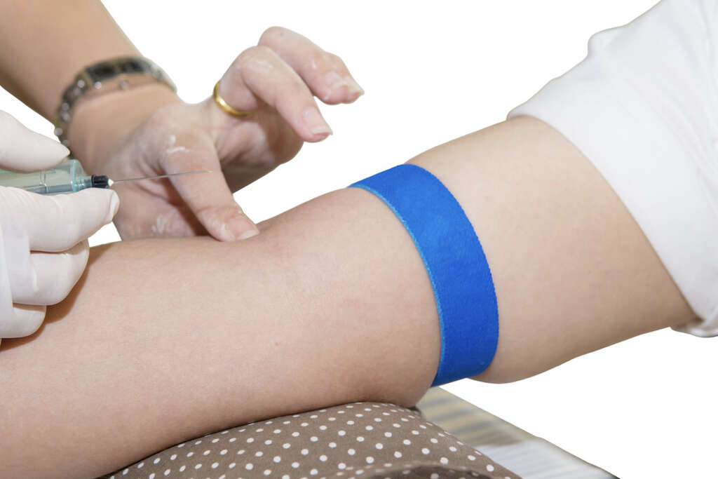 Diabetic Ketoacidosis