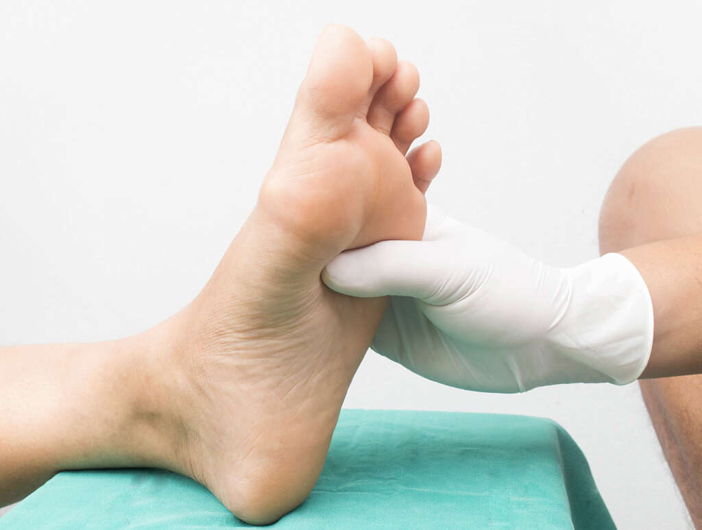 Diabetic Neuropathy