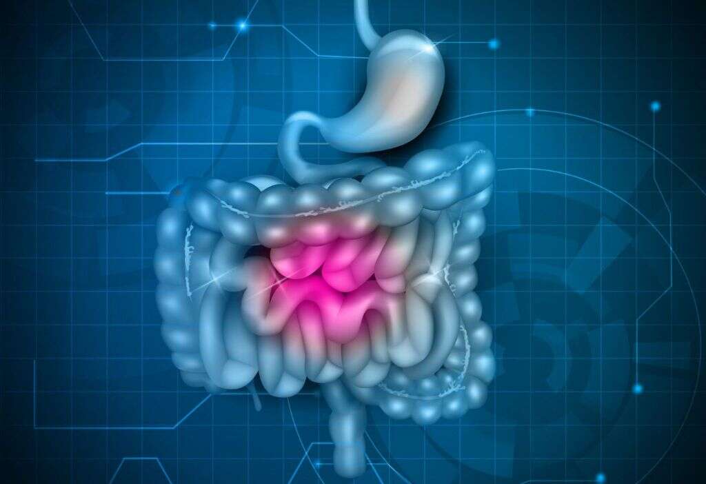 Duodenitis