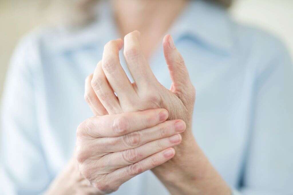 Dupuytren's Contracture