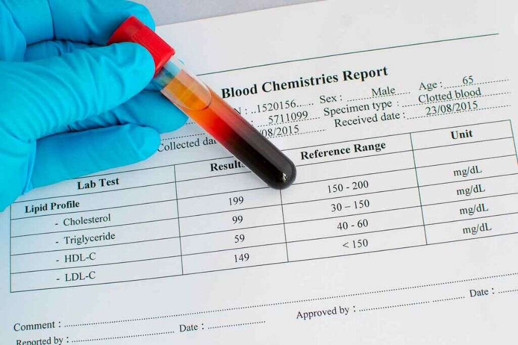 Dyslipidemia